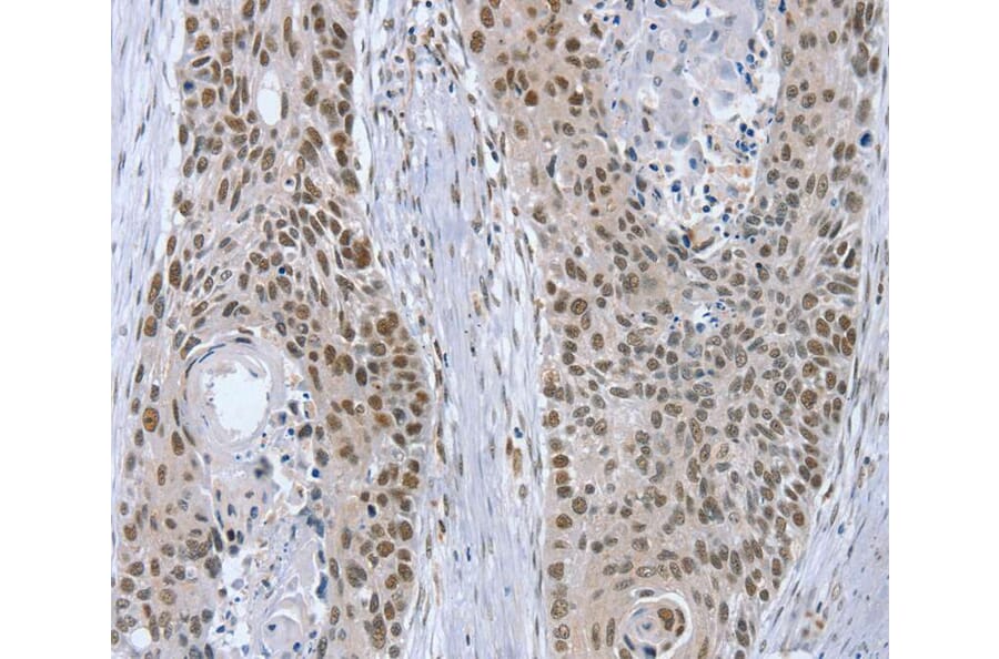 Immunohistochemistry - RNF20 Antibody from Signalway Antibody (40080) - Antibodies.com