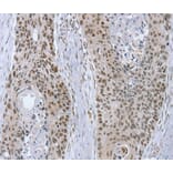 Immunohistochemistry - RNF20 Antibody from Signalway Antibody (40080) - Antibodies.com