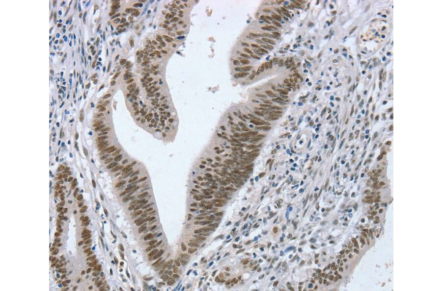 Immunohistochemistry - RNF20 Antibody from Signalway Antibody (40080) - Antibodies.com