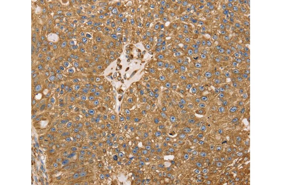 Immunohistochemistry - RRBP1 Antibody from Signalway Antibody (40086) - Antibodies.com