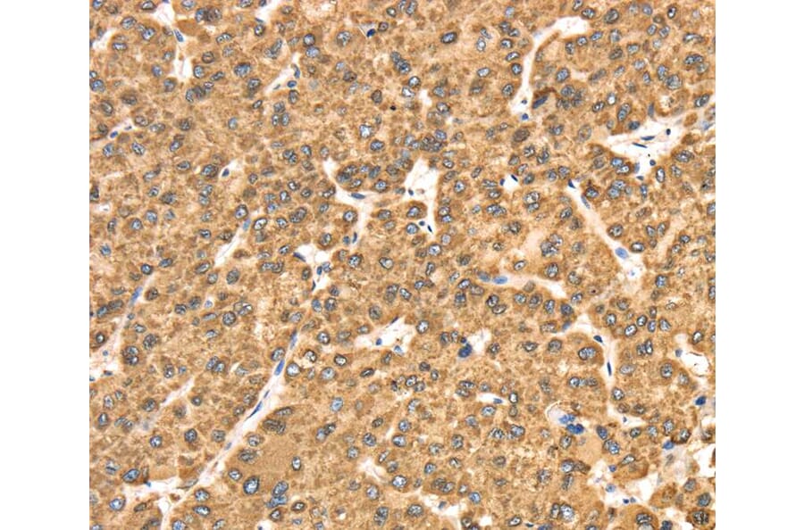 Immunohistochemistry - RRBP1 Antibody from Signalway Antibody (40086) - Antibodies.com