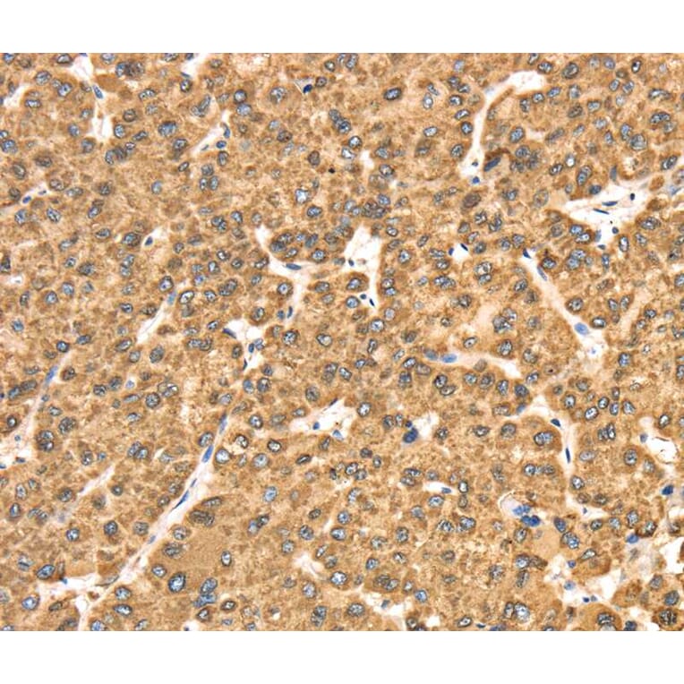 Immunohistochemistry - RRBP1 Antibody from Signalway Antibody (40086) - Antibodies.com
