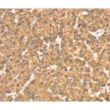 Immunohistochemistry - RRBP1 Antibody from Signalway Antibody (40086) - Antibodies.com