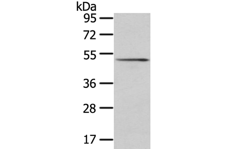 SRP54 Antibody from Signalway Antibody (40106) - Antibodies.com