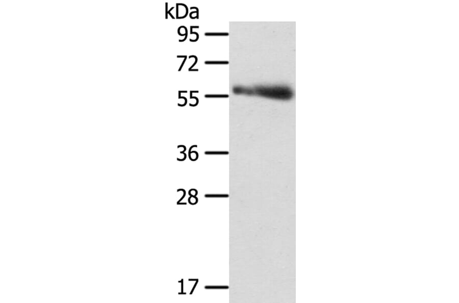 SRPK3 Antibody from Signalway Antibody (40122) - Antibodies.com