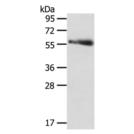 SRPK3 Antibody from Signalway Antibody (40122) - Antibodies.com