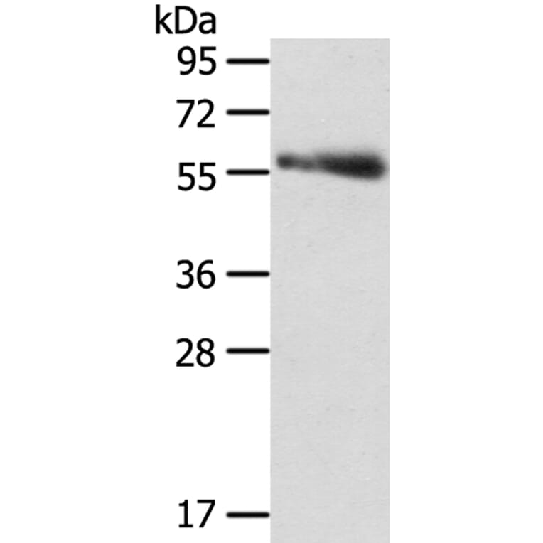 SRPK3 Antibody from Signalway Antibody (40122) - Antibodies.com