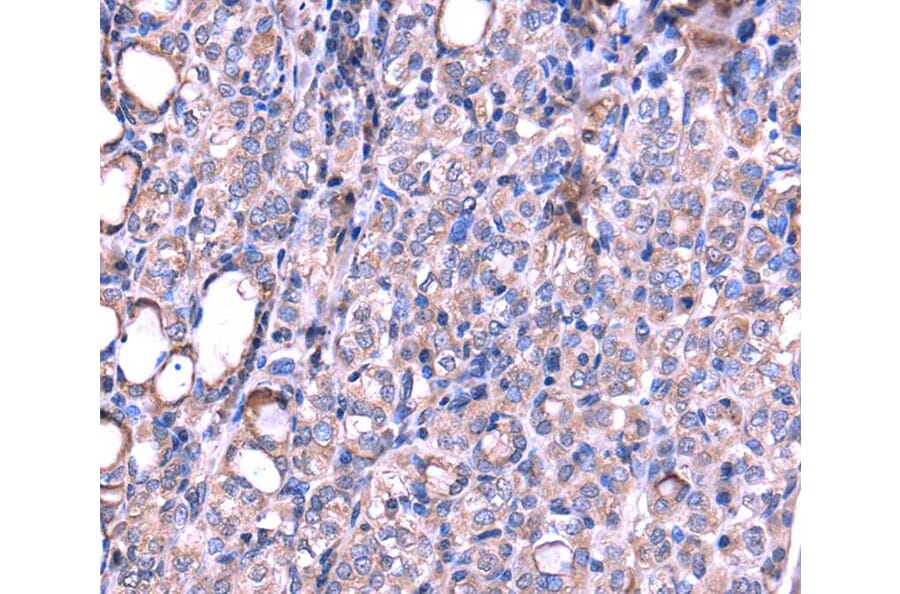 Immunohistochemistry - SRPK3 Antibody from Signalway Antibody (40122) - Antibodies.com