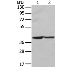 STX16 Antibody from Signalway Antibody (40128) - Antibodies.com