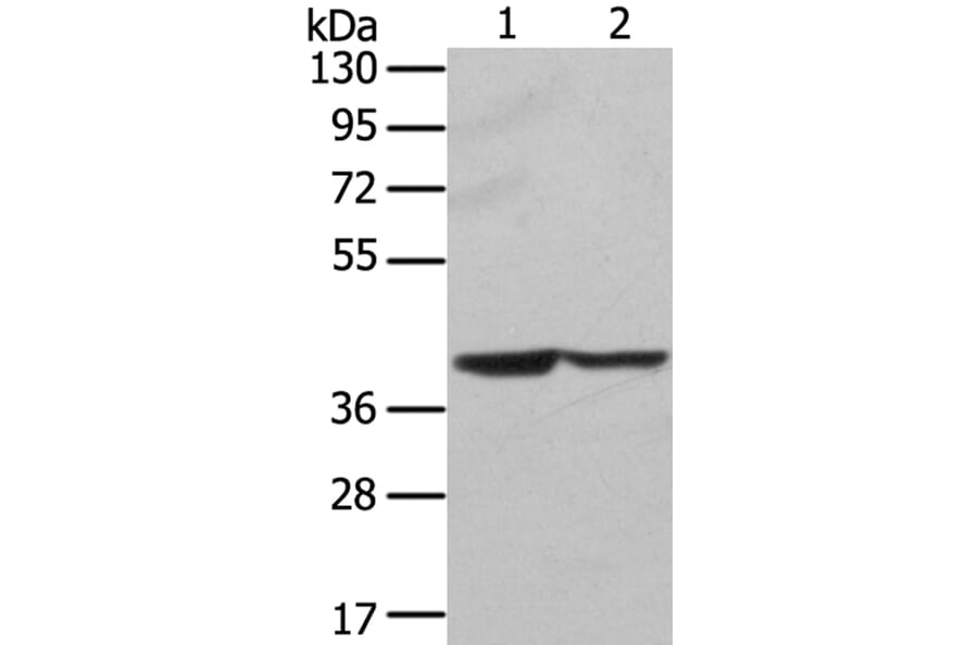 STX16 Antibody from Signalway Antibody (40128) - Antibodies.com