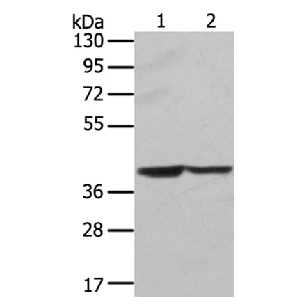 STX16 Antibody from Signalway Antibody (40128) - Antibodies.com