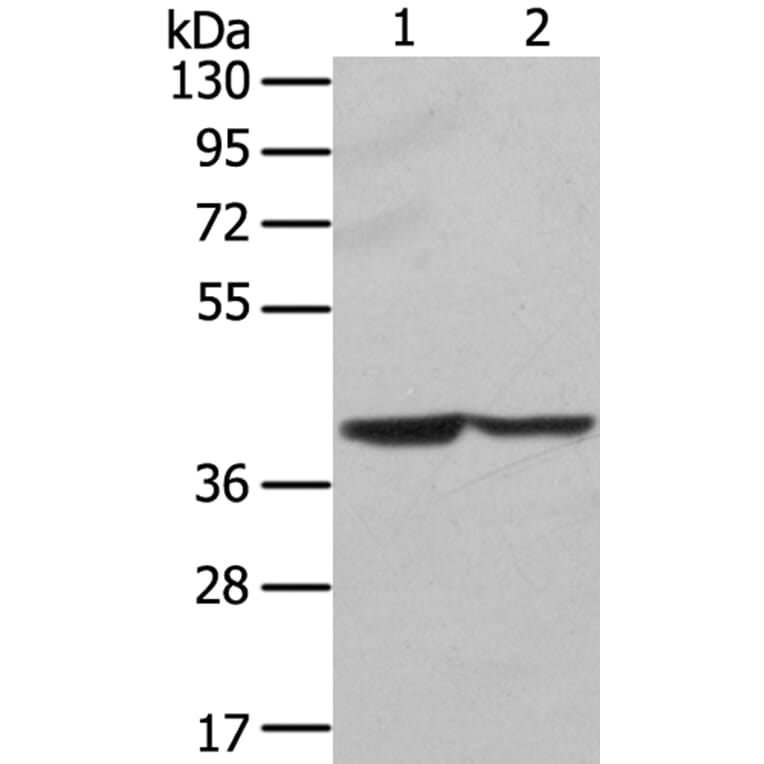 STX16 Antibody from Signalway Antibody (40128) - Antibodies.com