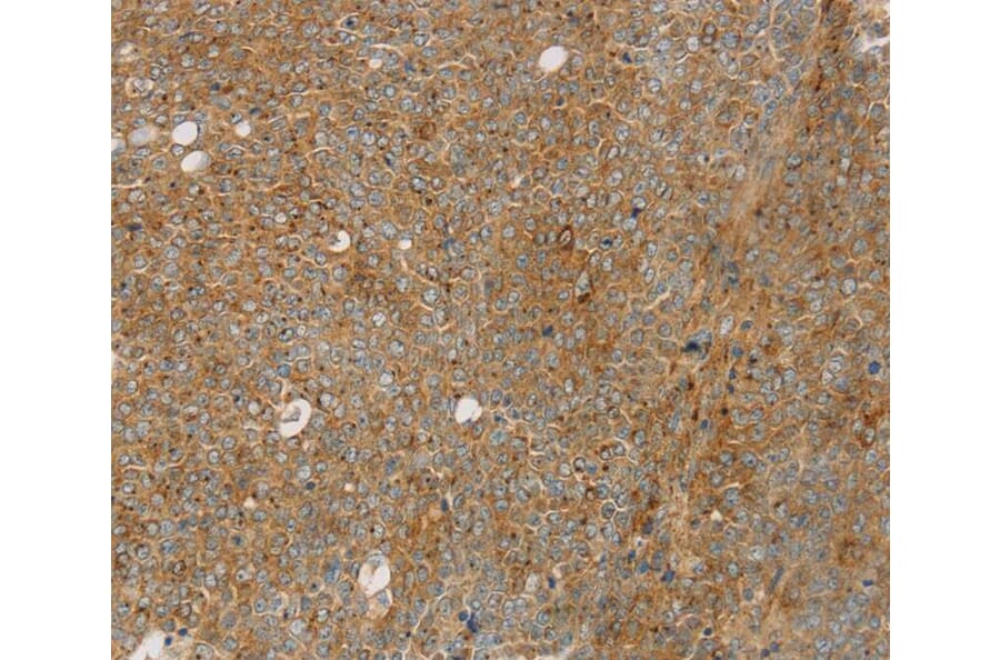 Immunohistochemistry - STX16 Antibody from Signalway Antibody (40128) - Antibodies.com
