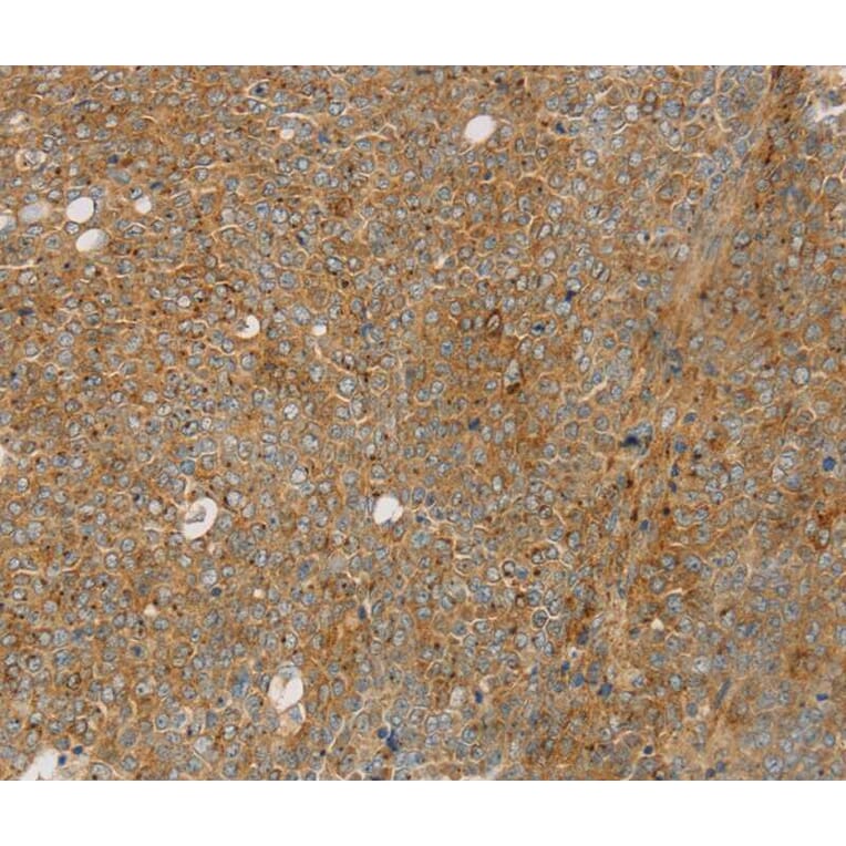 Immunohistochemistry - STX16 Antibody from Signalway Antibody (40128) - Antibodies.com