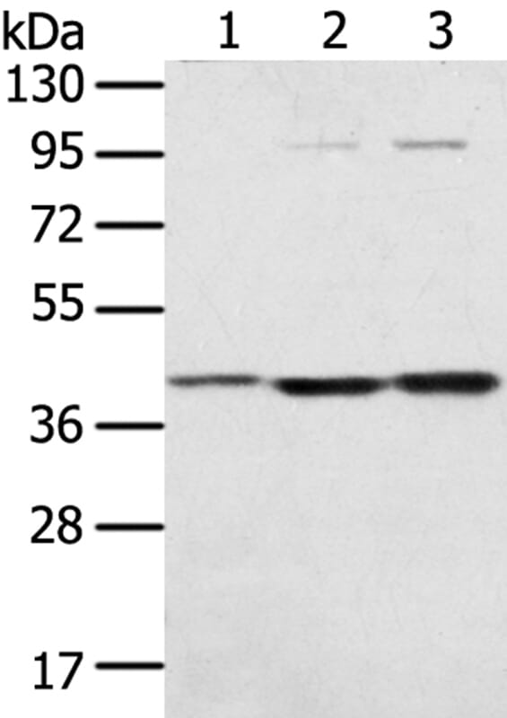 Gel: 8% SDS-PAGE Lysates (from left to right): Hepg2, TM4 and Raw264.7 cell. Amount of lysate: 40ug per lane Primary antibody: 1/300 dilution Secondary antibody dilution: 1/8000Exposure time: 20 seconds