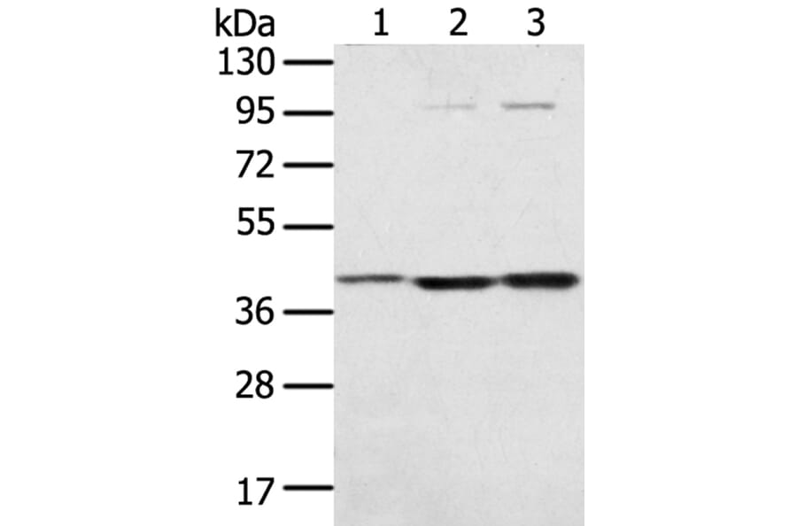 STX18 Antibody from Signalway Antibody (40129) - Antibodies.com