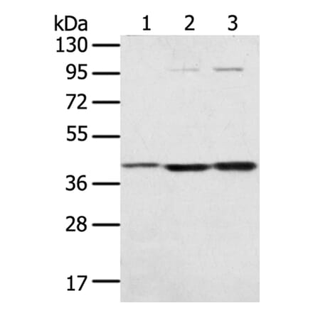 STX18 Antibody from Signalway Antibody (40129) - Antibodies.com