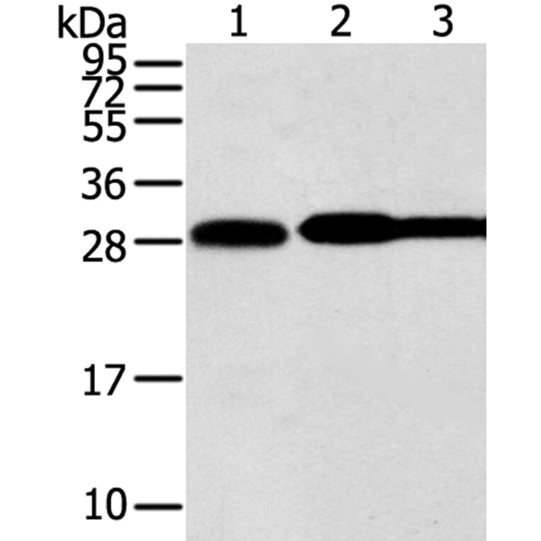 STX10 Antibody from Signalway Antibody (40131) - Antibodies.com
