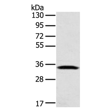 STX11 Antibody from Signalway Antibody (40132) - Antibodies.com