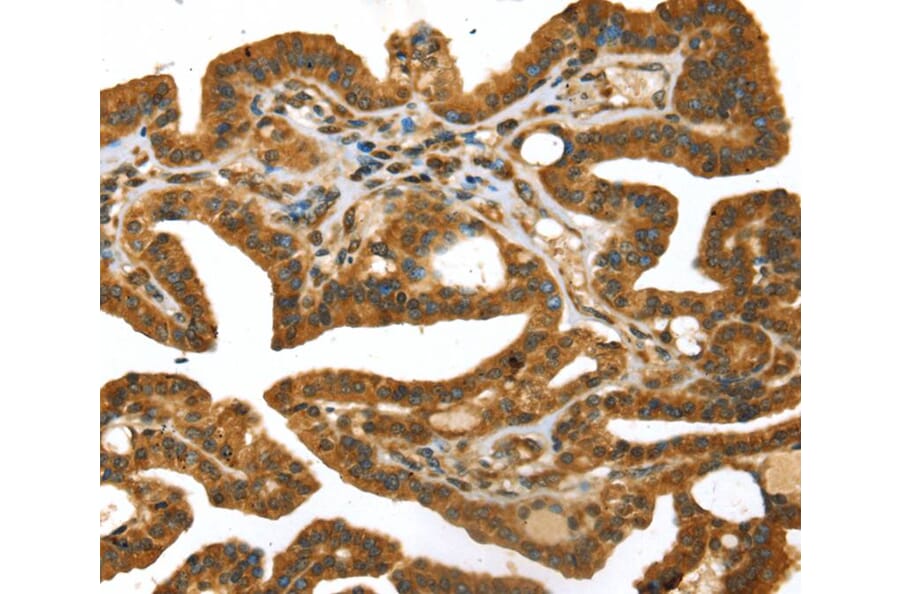 Immunohistochemistry - STX11 Antibody from Signalway Antibody (40132) - Antibodies.com