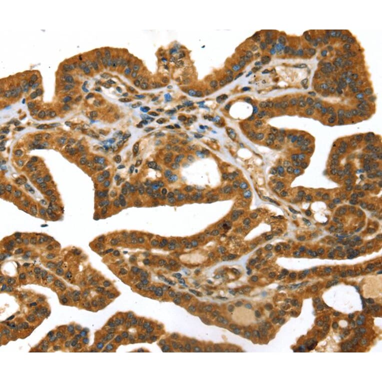Immunohistochemistry - STX11 Antibody from Signalway Antibody (40132) - Antibodies.com