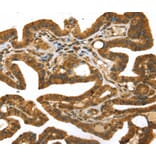 Immunohistochemistry - STX11 Antibody from Signalway Antibody (40132) - Antibodies.com
