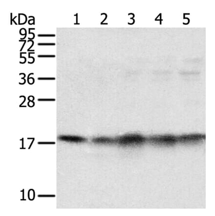 TAF11 Antibody from Signalway Antibody (40133) - Antibodies.com