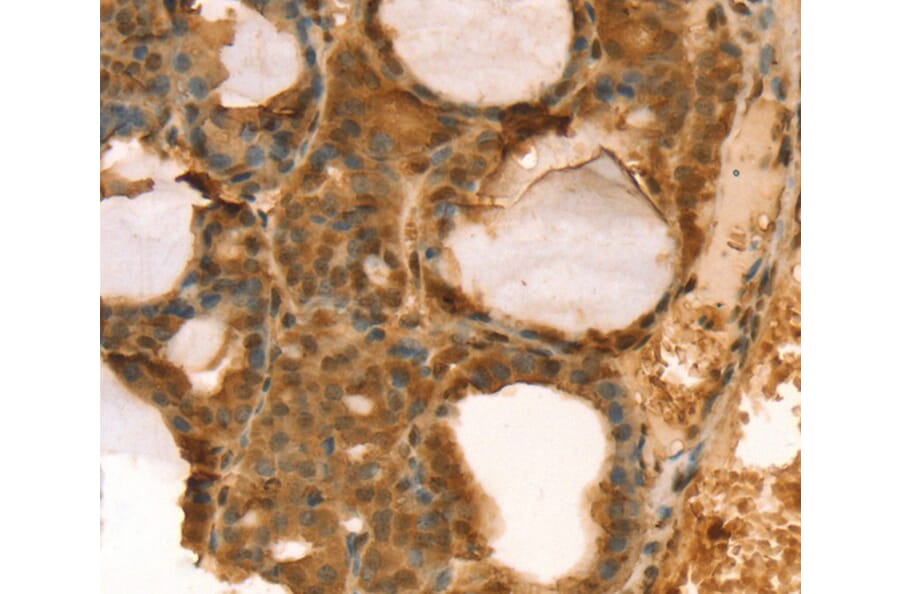 Immunohistochemistry - TAF11 Antibody from Signalway Antibody (40133) - Antibodies.com