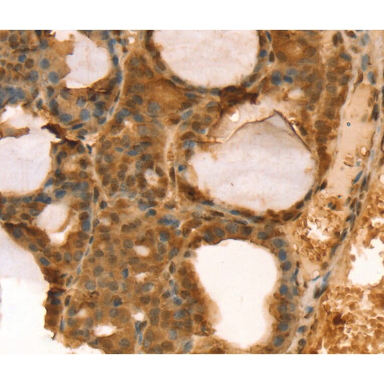 Immunohistochemistry - TAF11 Antibody from Signalway Antibody (40133) - Antibodies.com