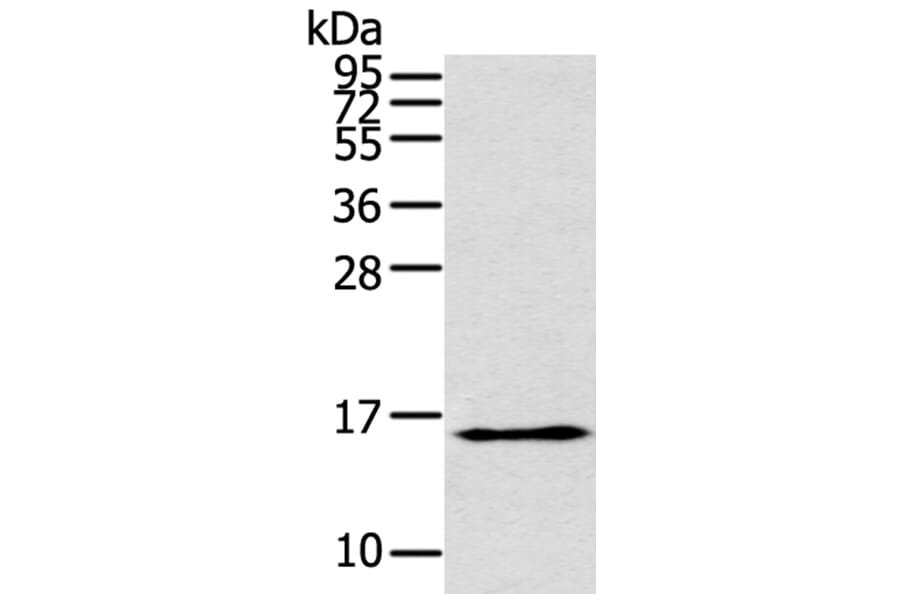 THRSP Antibody from Signalway Antibody (40146) - Antibodies.com