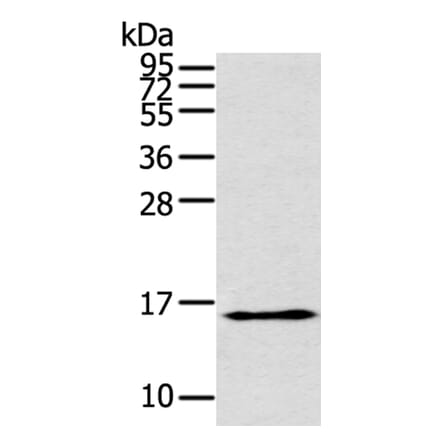 THRSP Antibody from Signalway Antibody (40146) - Antibodies.com