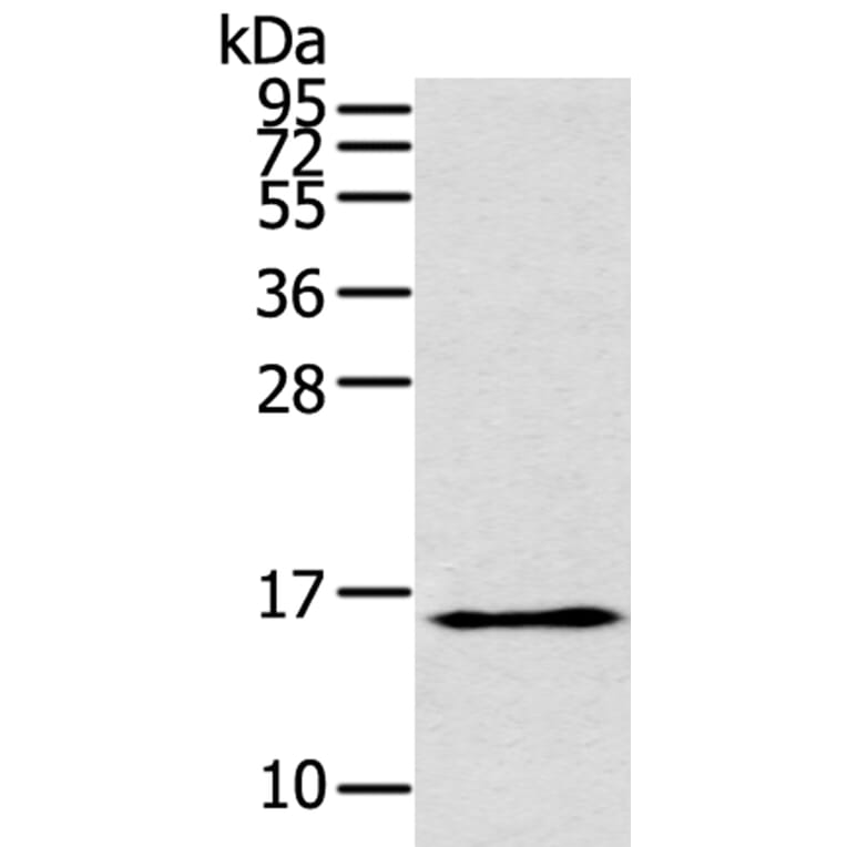 THRSP Antibody from Signalway Antibody (40146) - Antibodies.com