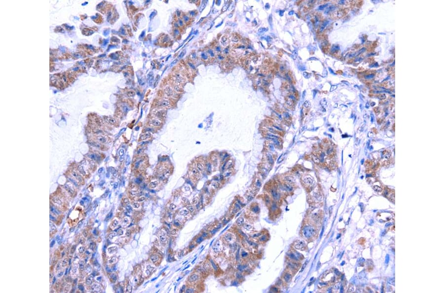 Immunohistochemistry - THRSP Antibody from Signalway Antibody (40146) - Antibodies.com
