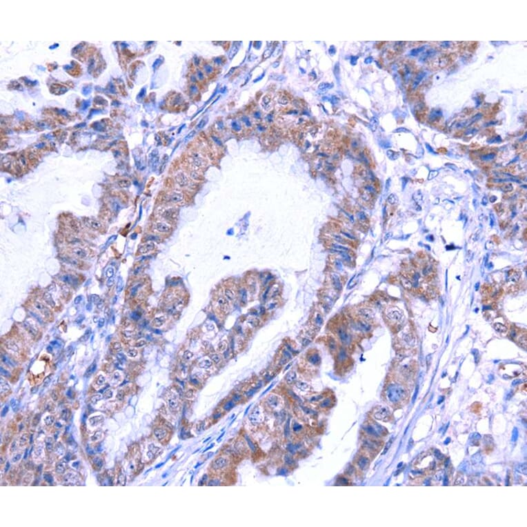 Immunohistochemistry - THRSP Antibody from Signalway Antibody (40146) - Antibodies.com