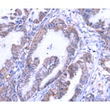 Immunohistochemistry - THRSP Antibody from Signalway Antibody (40146) - Antibodies.com