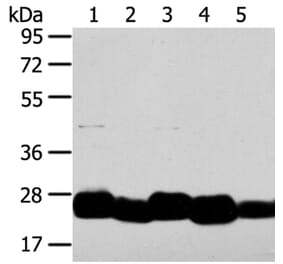 TMED4 Antibody from Signalway Antibody (40156) - Antibodies.com