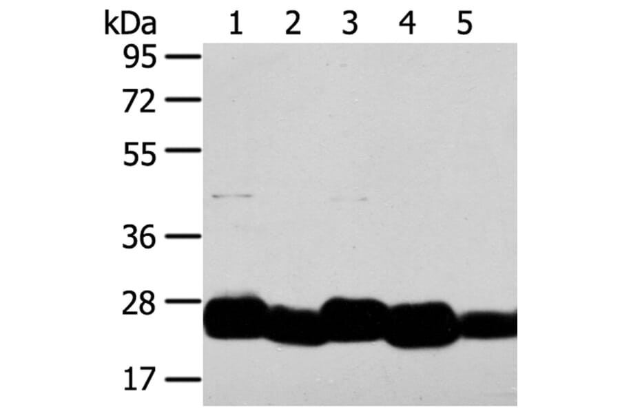 TMED4 Antibody from Signalway Antibody (40156) - Antibodies.com