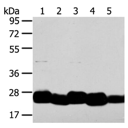 TMED4 Antibody from Signalway Antibody (40156) - Antibodies.com