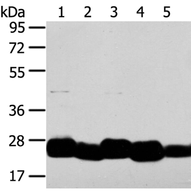 TMED4 Antibody from Signalway Antibody (40156) - Antibodies.com