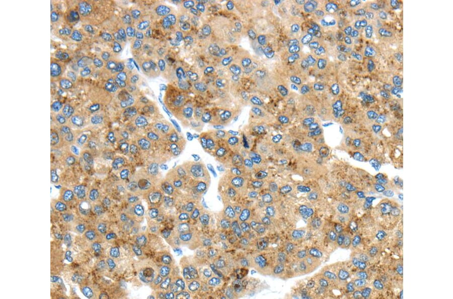 Immunohistochemistry - TMED4 Antibody from Signalway Antibody (40156) - Antibodies.com