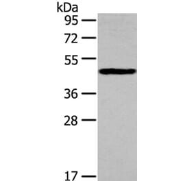 IL3RA Antibody from Signalway Antibody (40185) - Antibodies.com