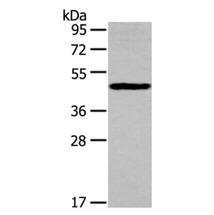IL3RA Antibody from Signalway Antibody (40185) - Antibodies.com