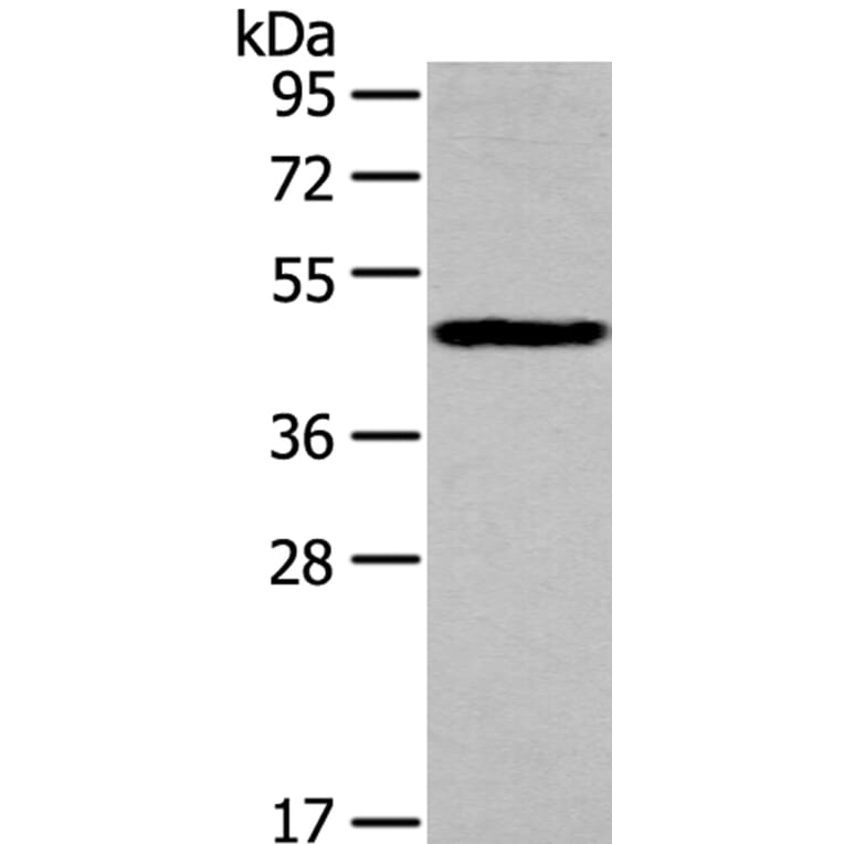 IL3RA Antibody from Signalway Antibody (40185) - Antibodies.com