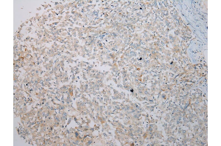Immunohistochemistry - IL3RA Antibody from Signalway Antibody (40185) - Antibodies.com