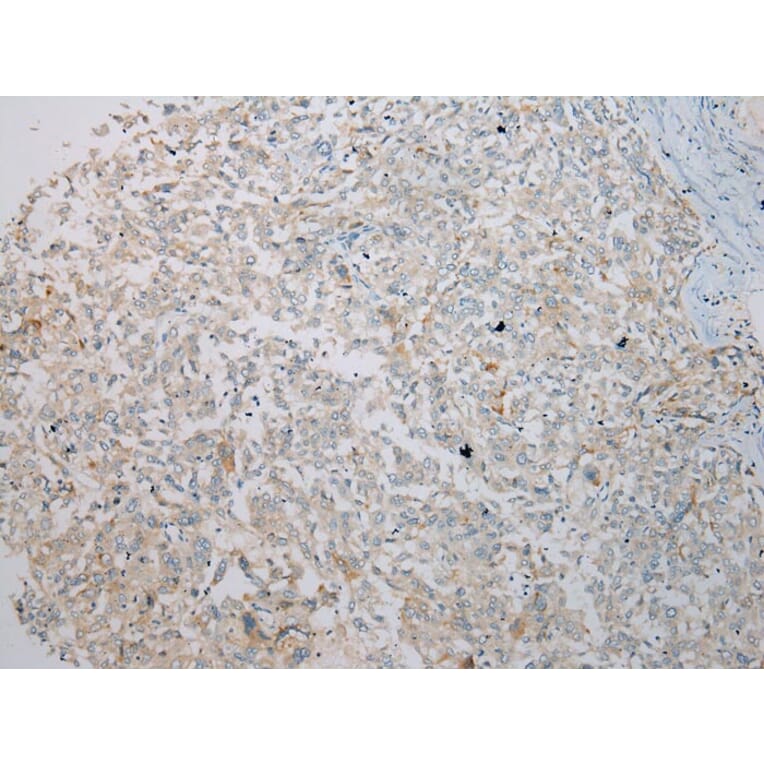 Immunohistochemistry - IL3RA Antibody from Signalway Antibody (40185) - Antibodies.com