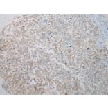 Immunohistochemistry - IL3RA Antibody from Signalway Antibody (40185) - Antibodies.com