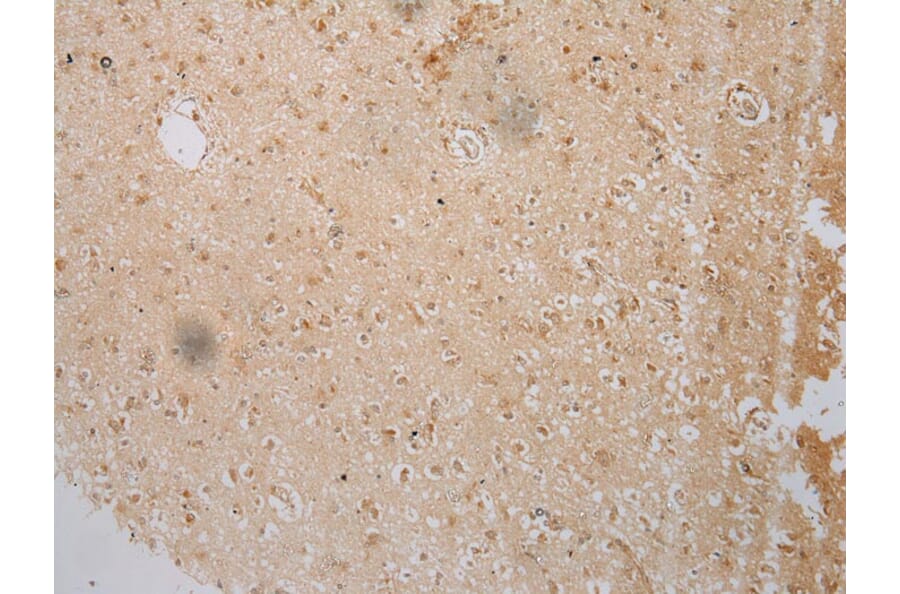 Immunohistochemistry - IL3RA Antibody from Signalway Antibody (40185) - Antibodies.com