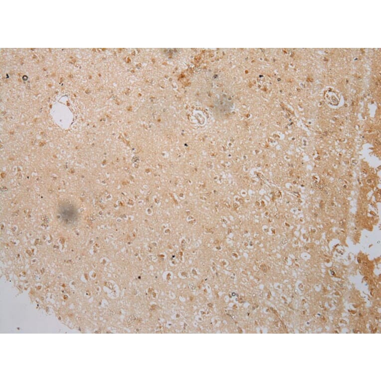 Immunohistochemistry - IL3RA Antibody from Signalway Antibody (40185) - Antibodies.com
