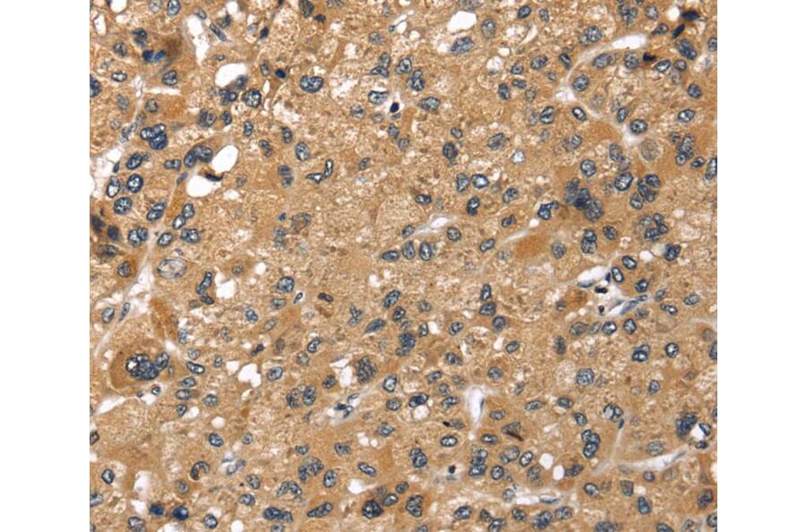 Immunohistochemistry - LONP1 Antibody from Signalway Antibody (40199) - Antibodies.com