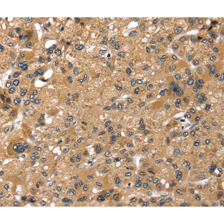 Immunohistochemistry - LONP1 Antibody from Signalway Antibody (40199) - Antibodies.com